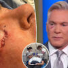 Gossip & Rumors: Abc Weatherman Sam Champion Shares Cancer Diagnosis