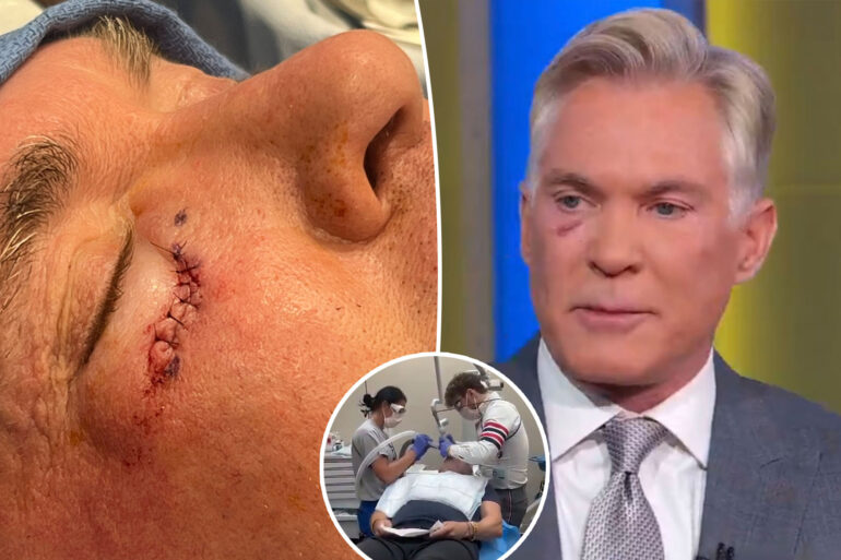 Gossip & Rumors: Abc Weatherman Sam Champion Shares Cancer Diagnosis