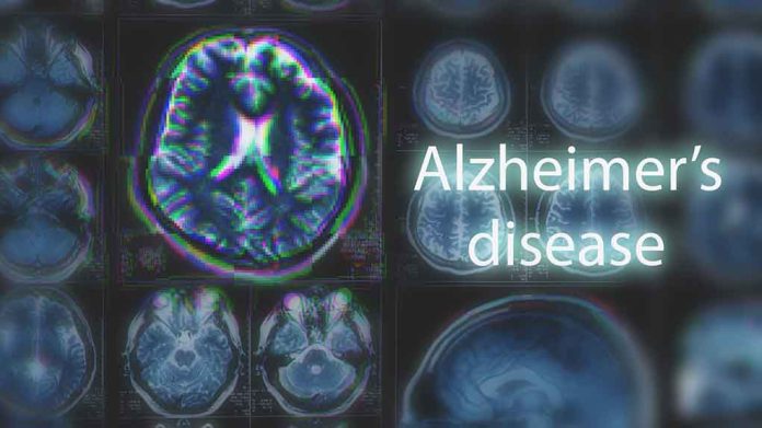 Brain scans labeled Alzheimers disease background