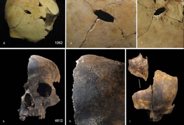 Examples of skulls from the assemblage, with evidence for blunt force trauma and cut marks.