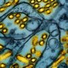 Travel & Lifestyle: Cdc Says Bird Flu Likely Mutated Within