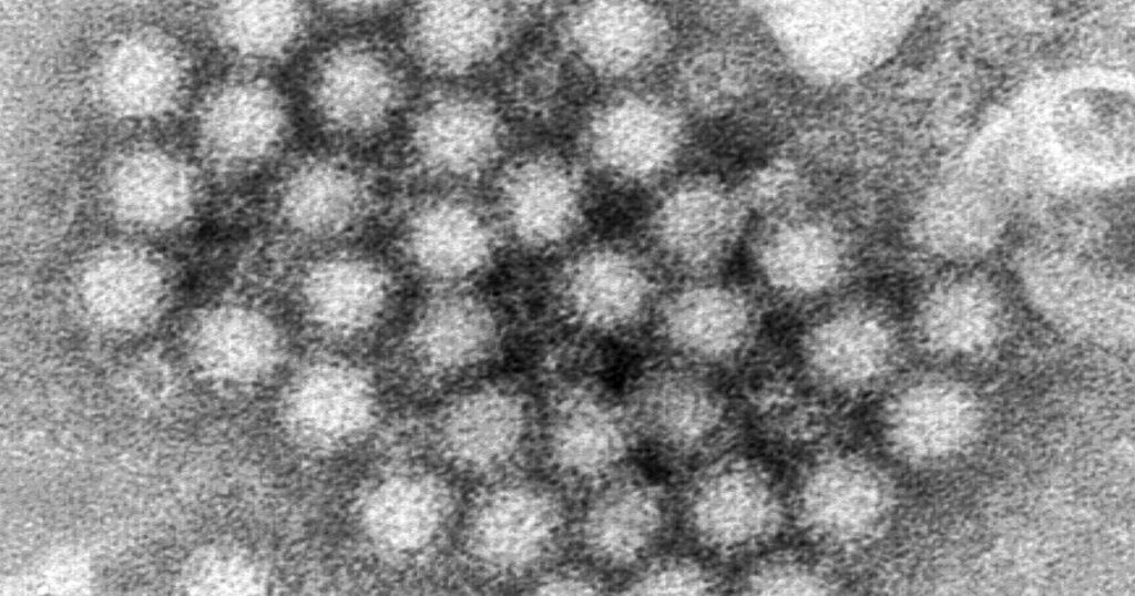 Travel & Lifestyle: Nasty Norovirus Is Back In Full Force