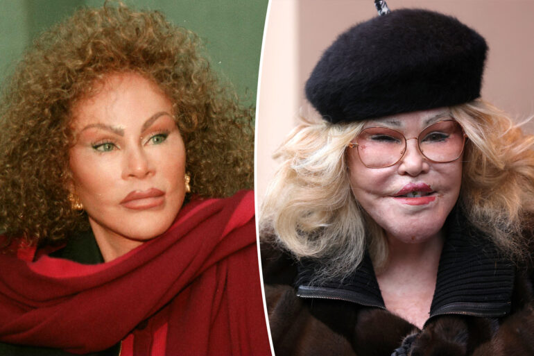 Gossip & Rumors: 'catwoman' Jocelyn Wildenstein’s Final Resting Place Revealed: