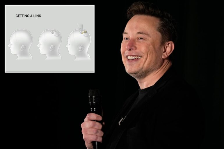 Science & Tech: Elon Musk Says Third Person Gets Neuralink