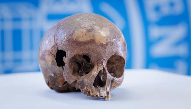 Skull recovered from the ruins of Ephess in 1929, which was once thought to belong to Cleopatra’s sister,  Arsinoë IV.