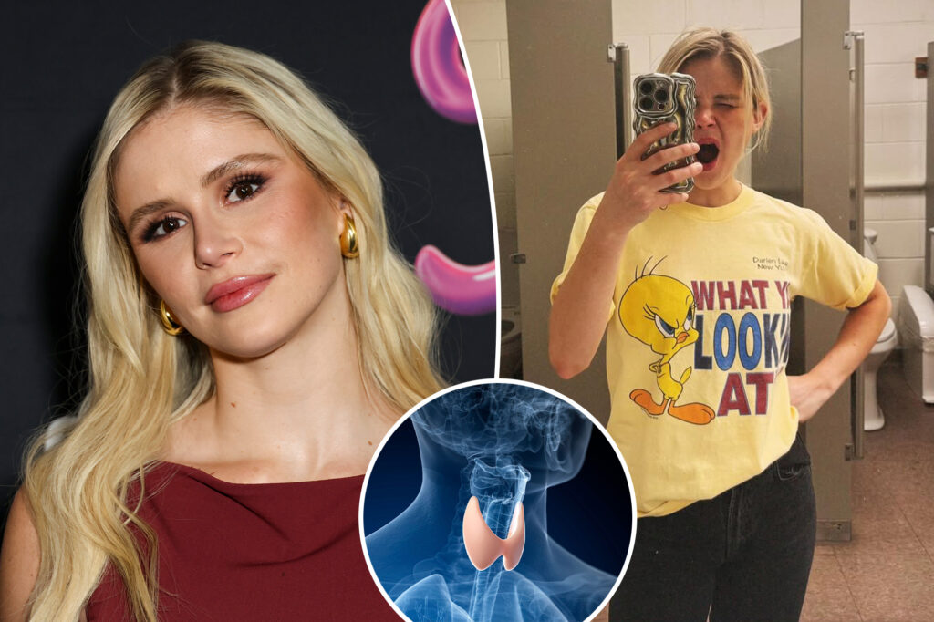 Gossip & rumors: what is graves' disease? all about erin