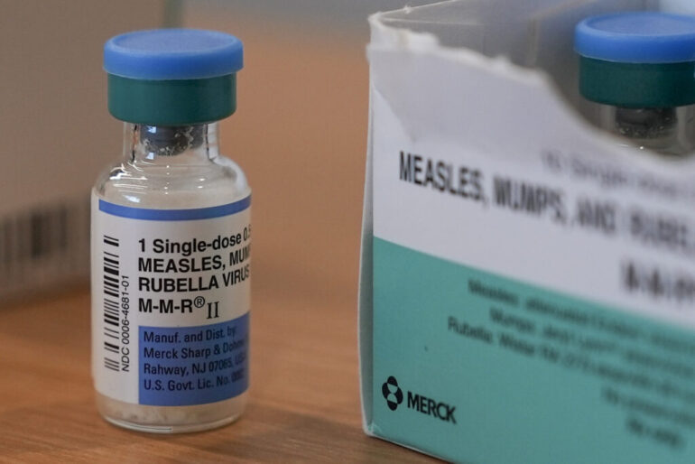 Politics: canada outpaces us in measles cases – ussa news