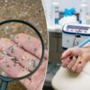 Science & tech: this blood filter may flush microplastics from