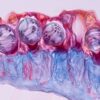 Nematocysts or stinging cells on a tentacle of a Portuguese man-of-war, magnified 250 times. The oval structures are nematocysts, which, when stimulated, release a coiled hollow tubule (seen inside the stinging cells) that can penetrate the target. Nematocysts also contain a toxin that aids in immobilizing prey. Portuguese man-of-wars can paralyze fish and even cause injuries to humans.