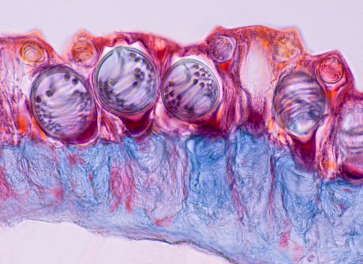 Nematocysts or stinging cells on a tentacle of a Portuguese man-of-war, magnified 250 times. The oval structures are nematocysts, which, when stimulated, release a coiled hollow tubule (seen inside the stinging cells) that can penetrate the target. Nematocysts also contain a toxin that aids in immobilizing prey. Portuguese man-of-wars can paralyze fish and even cause injuries to humans.