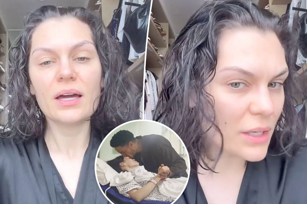 Gossip & rumors: jessie j reveals her hair is falling