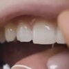 NIH Says Vaccines Delivered By Dental Floss Might Be "Promising" * 100PercentFedUp.com * by Danielle