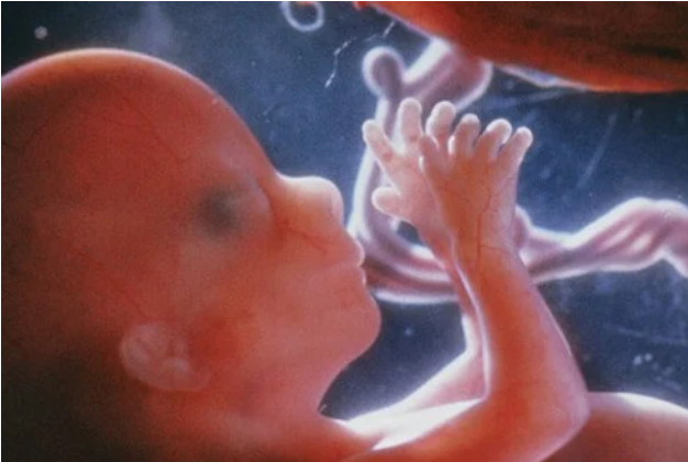Politics: texas and florida are fighting to stop the abortion