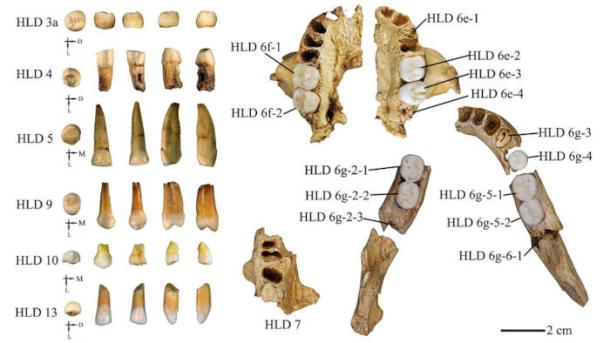 Graphic of the teeth used in the study.