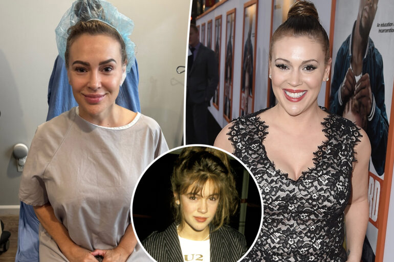 Gossip & rumors: alyssa milano gets her breast implants removed