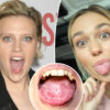 Gossip & rumors: what is 'geographic tongue'? all about 'snl'