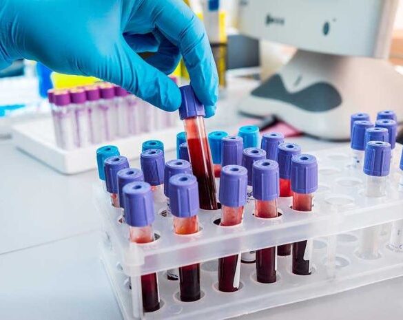 Gloved hand handling blood samples in a laboratory.