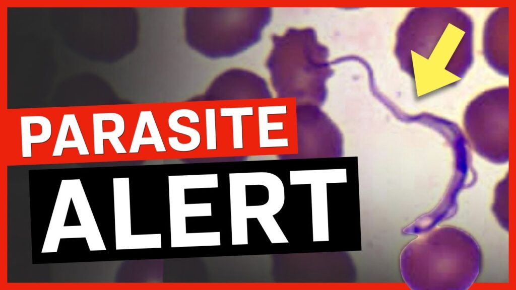 300,000-Plus Americans Infected With This Dangerous Parasite