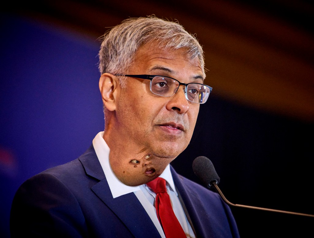 Satire news: nih director’s pulsing neck tumor announces cancer research