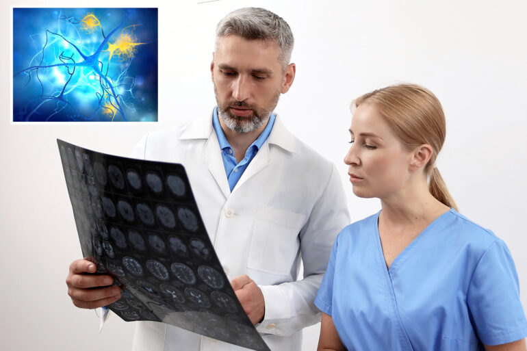 Science & tech: new mri brain scan can predict alzheimer's