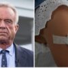 Health and Human Services Secretary Robert F. Kennedy Jr. fired all 17 members of the CDC’s vaccine advisory panel in June.