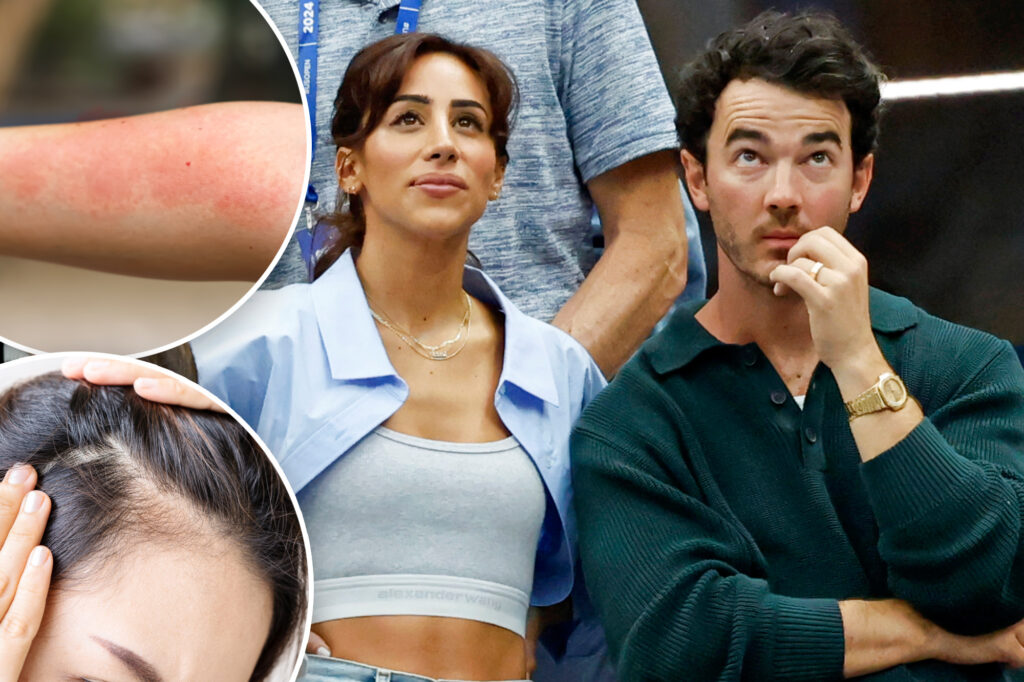 Gossip & rumors: danielle jonas diagnosed with lyme disease after