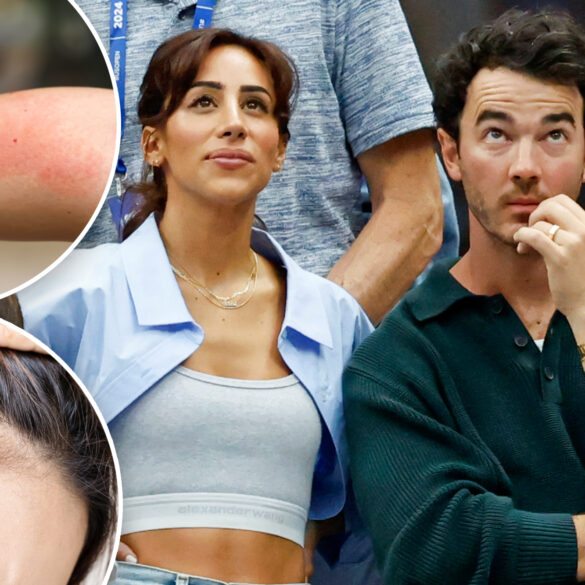 Gossip & rumors: danielle jonas diagnosed with lyme disease after