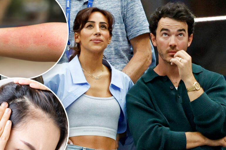Gossip & rumors: danielle jonas diagnosed with lyme disease after
