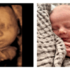 Politics: florida heartbeat law is saving 300 babies from abortion