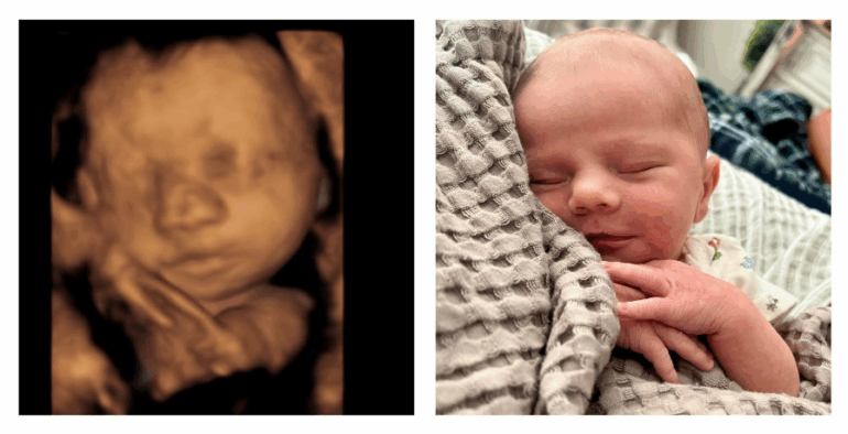 Politics: florida heartbeat law is saving 300 babies from abortion