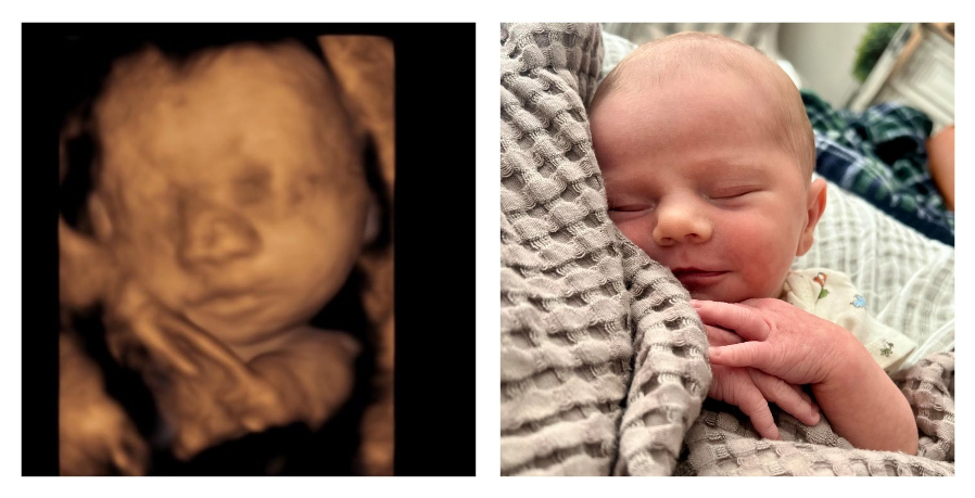 Politics: florida heartbeat law is saving 300 babies from abortion