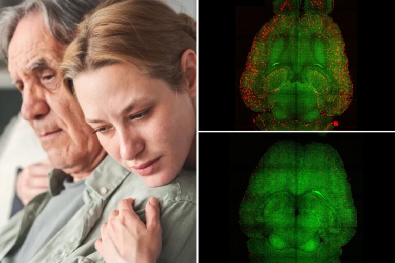 Science & tech: nanotech used to reverse alzheimer's disease in