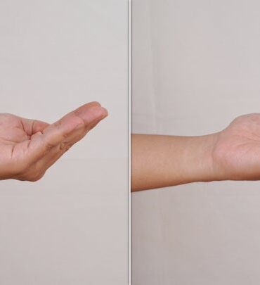 Can simple hand exercises really prevent dementia?