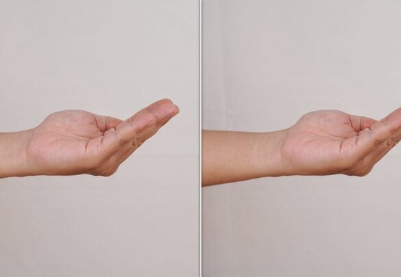 Can simple hand exercises really prevent dementia?