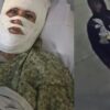 Christian Woman Suffers Severe Burns in Random Chemical Attack * 100PercentFedUp.com * by Kaley