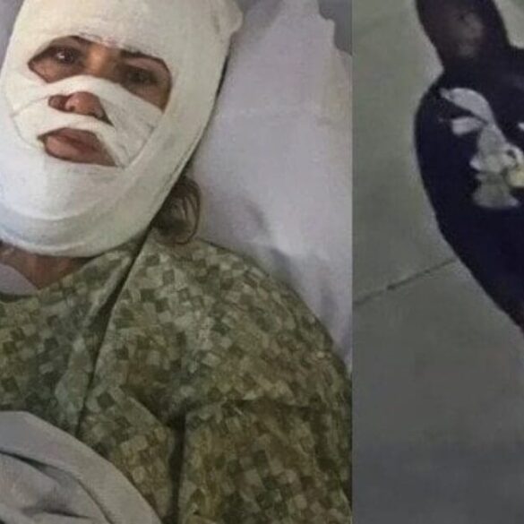 Christian Woman Suffers Severe Burns in Random Chemical Attack * 100PercentFedUp.com * by Kaley