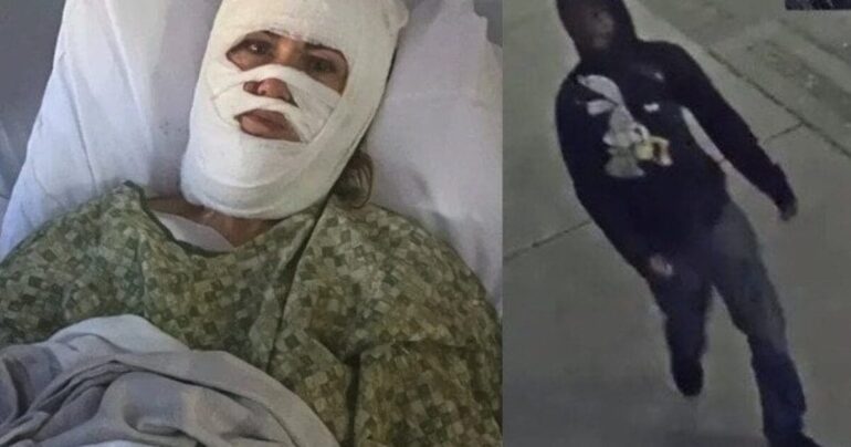 Christian Woman Suffers Severe Burns in Random Chemical Attack * 100PercentFedUp.com * by Kaley