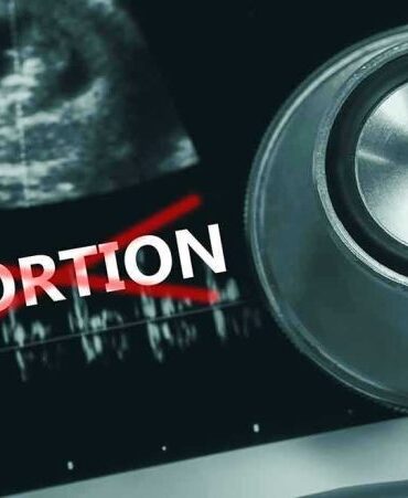 Ultrasound, stethoscope, and ABORTION crossed out in red.