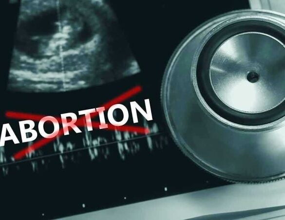 Ultrasound, stethoscope, and ABORTION crossed out in red.