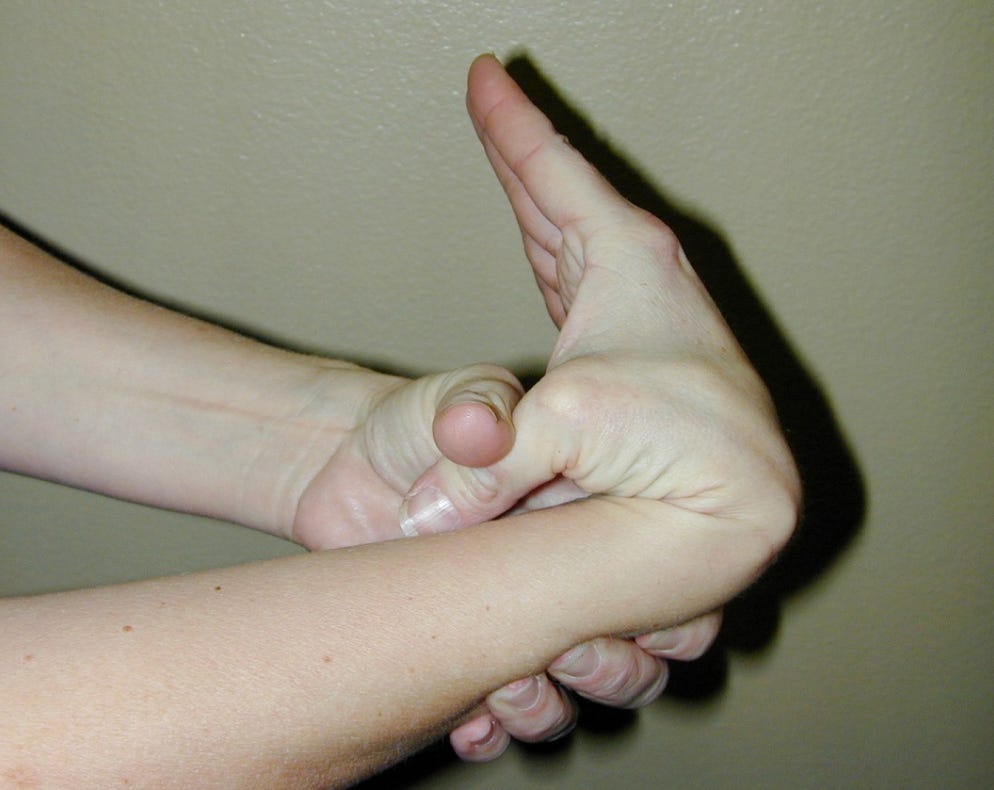 Politics: the hidden link between hypermobility, vaccine injury and fluid