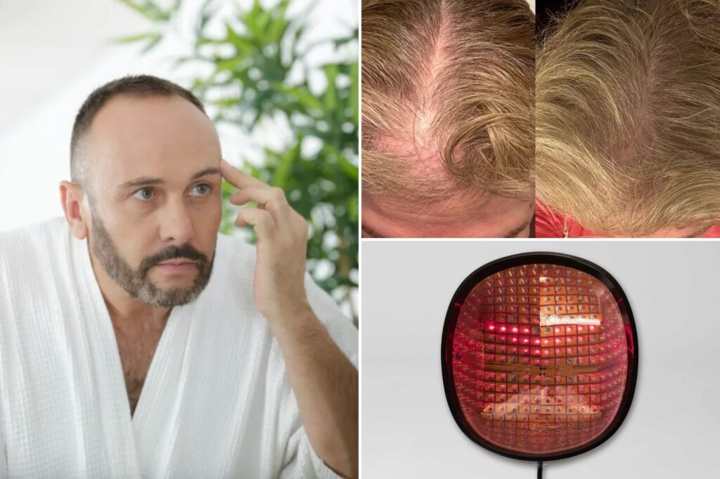 Science & tech: does red ligh therapy for hair loss