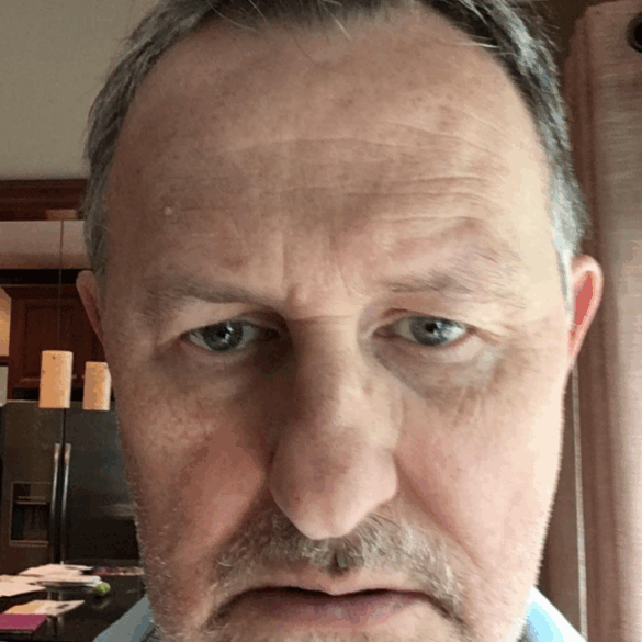 The author on "a bad day at home in June 2018," he writes. "This was seven months after hemorrhage. I was still trying to work and find an attorney to sue the doctors for malpractice."