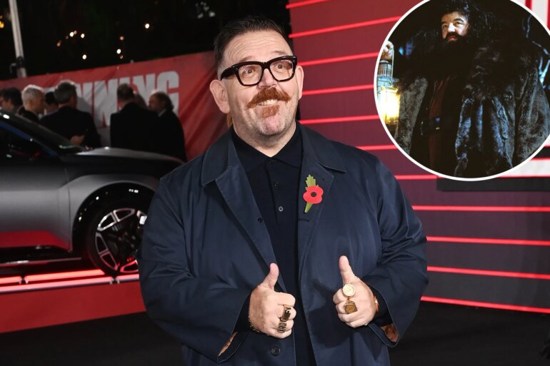 GOSSIP & RUMORS: 'Harry Potter' star reveals the insane way