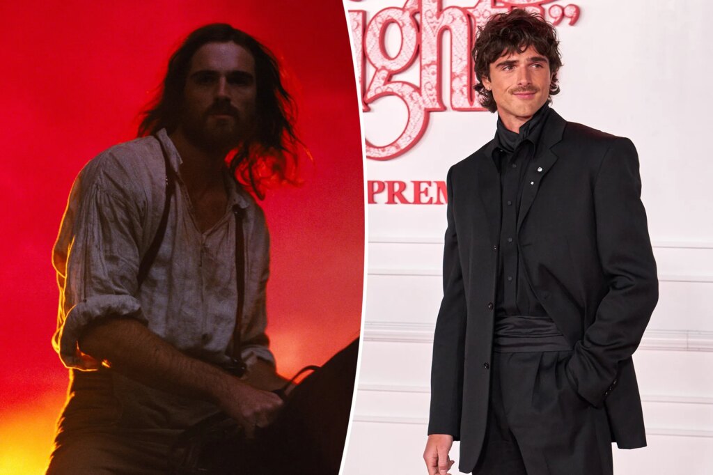 GOSSIP & RUMORS: Jacob Elordi suffered second degree burns after bizarre