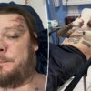 GOSSIP & RUMORS: Pawn Stars' Corey Harrison breaks 11 ribs