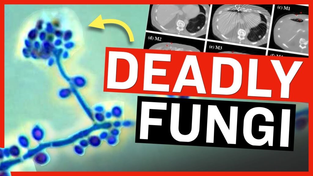 Scientists Warn Deadly Fungi Now Infecting Humans