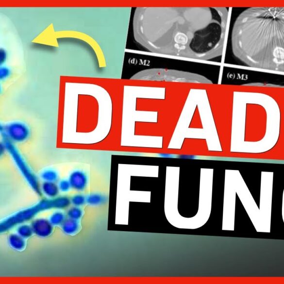 Scientists Warn Deadly Fungi Now Infecting Humans