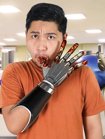 SATIRE NEWS: Prosthetic Hand Recipient Slowly Relearning To Lick Barbecue