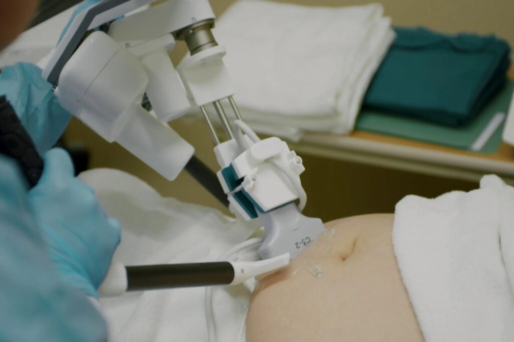 SCIENCE & TECH: Alabama’s plan to put robots in maternity