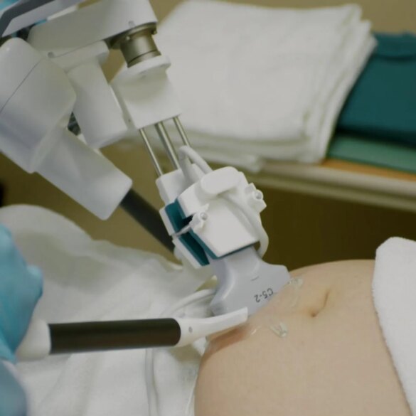 SCIENCE & TECH: Alabama’s plan to put robots in maternity